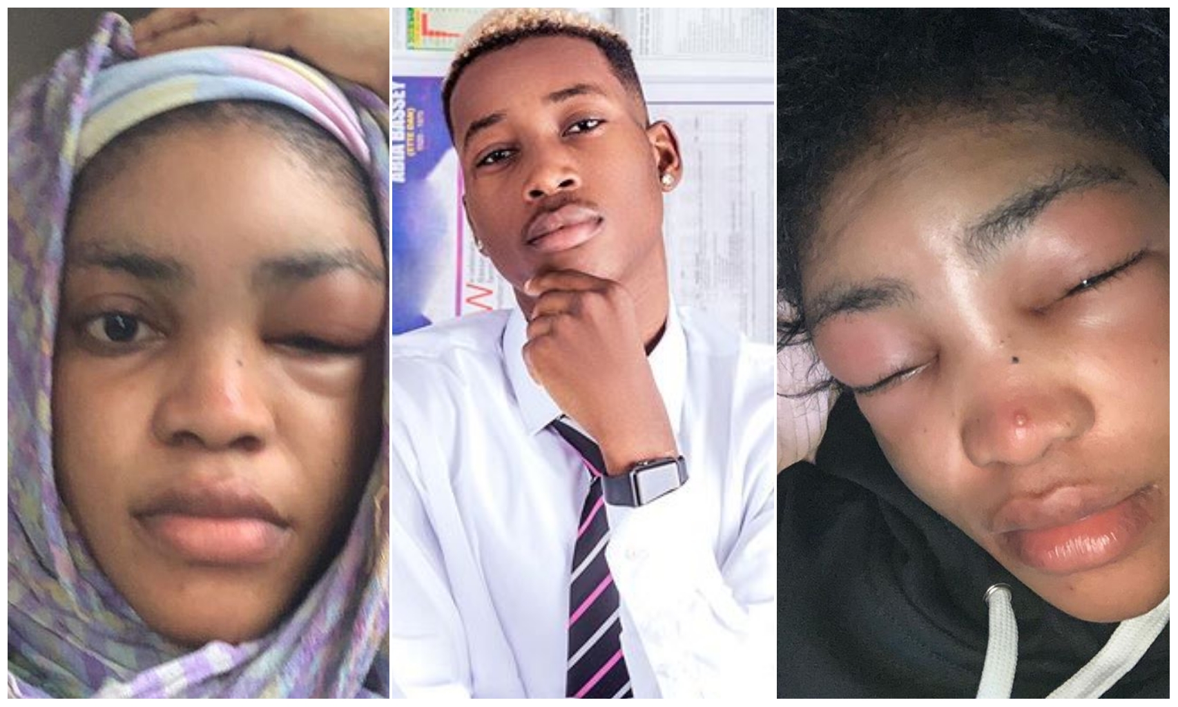 Singer Lil Frosh accused of physically abusing his girlfriend, Gift (See photos of her swollen face)